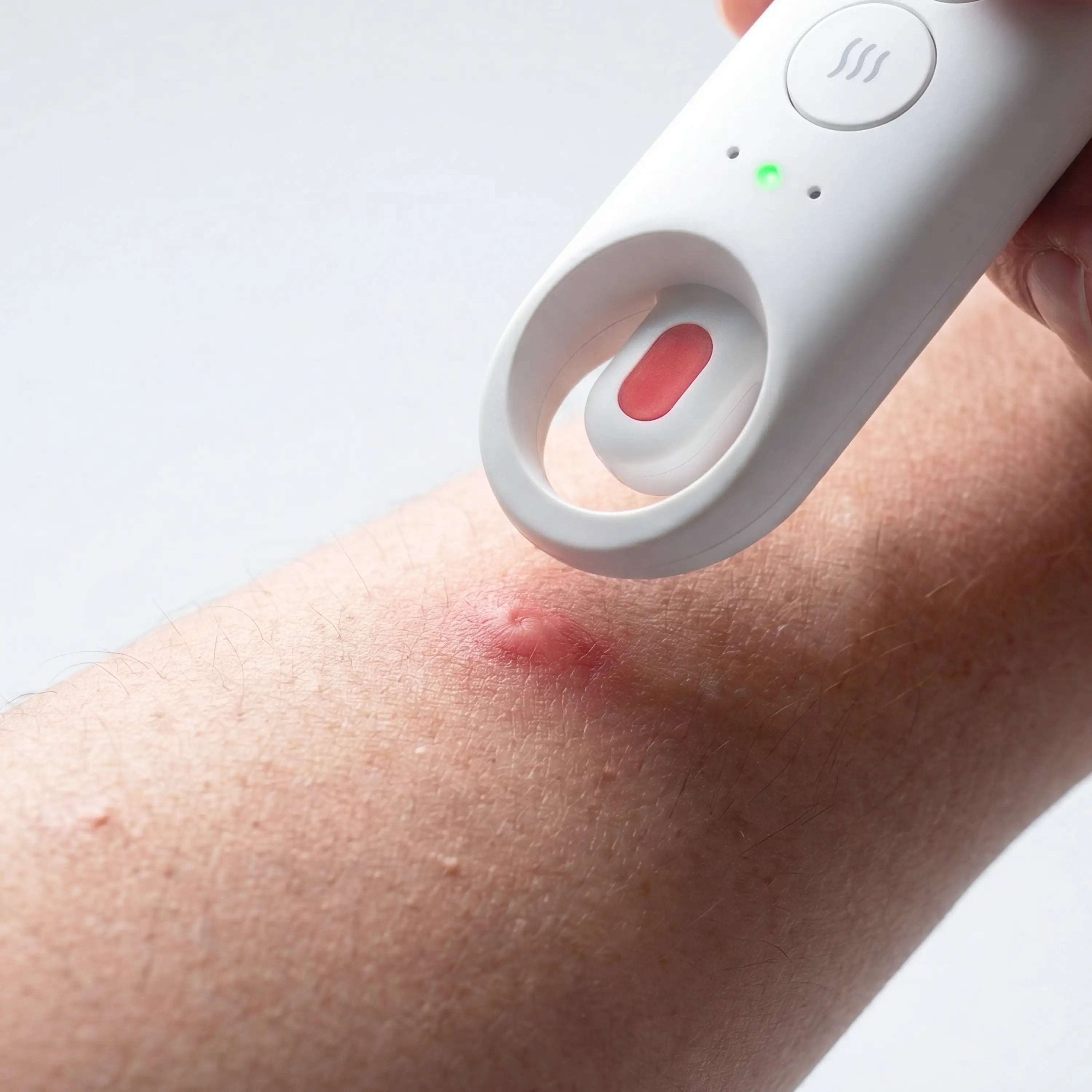 ihealth-d-itch-stick-stichheiler-bei-m-ckenstichen image 6